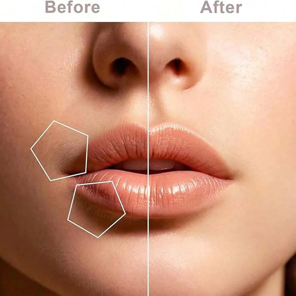 Depiladora Facial Femenina